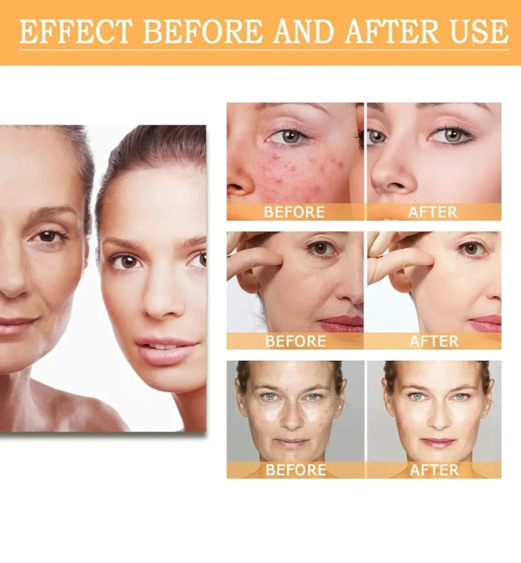 The Ordinary. Glycolic Acid 7% Toning Solution (pH ~3.6) 8fl oz.